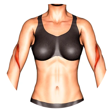 Braquial